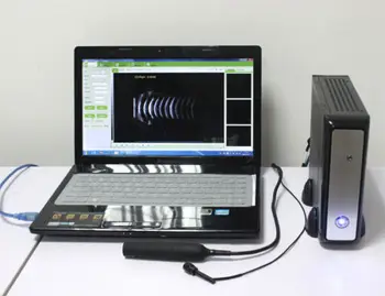 ММ портативный офтальмологический A/B сканер Ультразвуковой диагностики глаза частотой 10 МГц