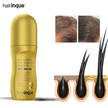 Витаминные средства для роста волос, Сыворотка против выпадения волос, средство для лечения кожи головы, Масло для роста волос для мужчин и женщин